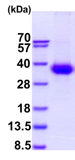 15% SDS-PAGE (3 μg)
